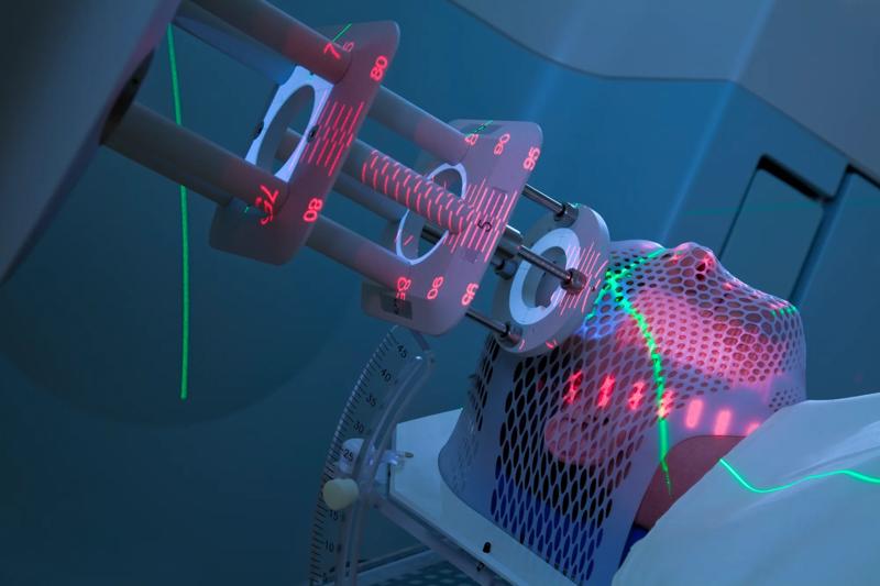 COLOUR-IMAGE_healthcare-radiotherapy-cancer-treatment_feb26