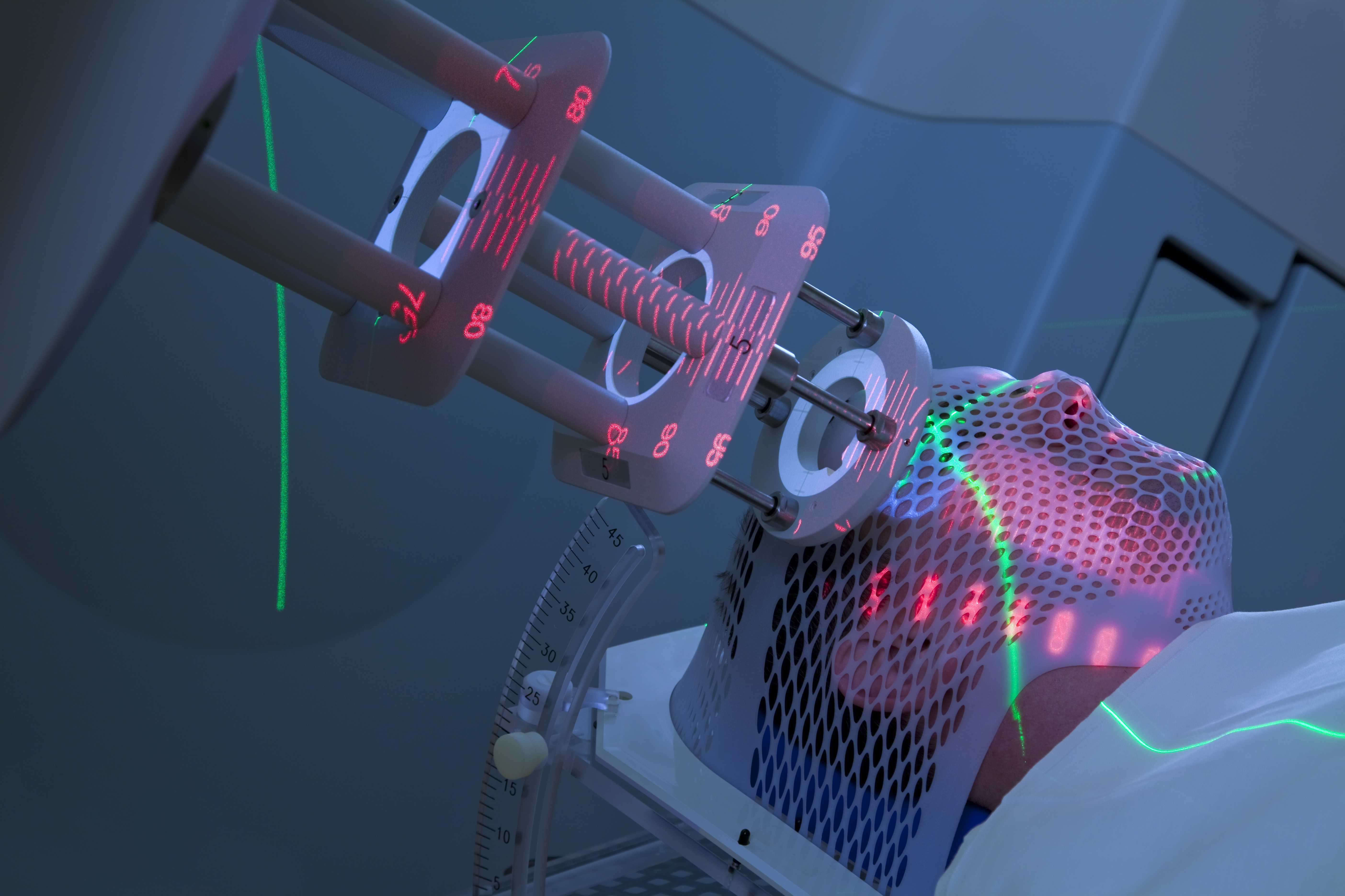 COLOUR-IMAGE_healthcare-radiotherapy-cancer-treatment_feb26